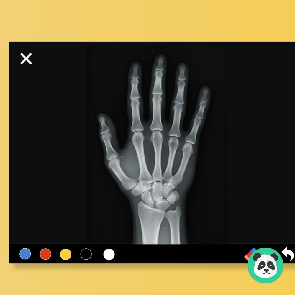 Interactive X-ray Medical Training